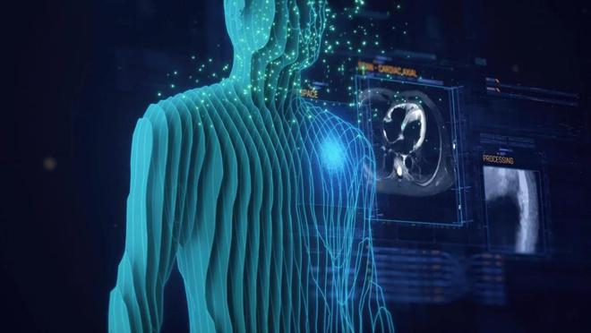 聚龄高科技电子WMS用户飞利浦AI与精准医疗重塑卒中护理未来